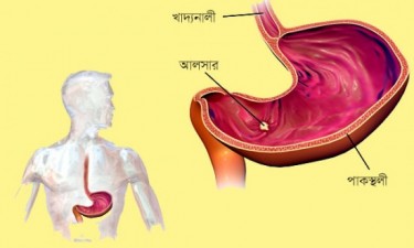 bdnews,bd news,bangla news,bangla newspaper ,bangla news paper,bangla news 24,banglanews,bd news 24,bd news paper,all bangla news paper,all bangla newspaper